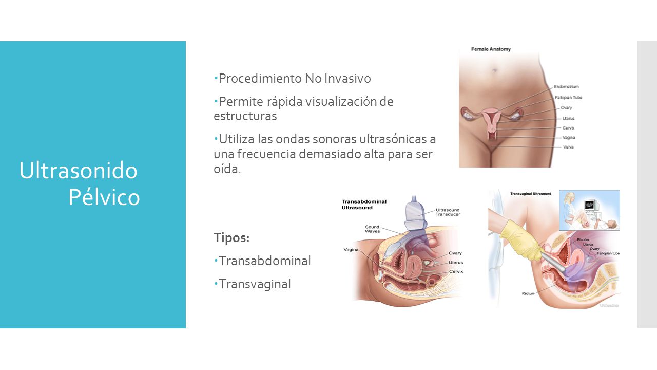 Procedimiento de ultrasonido pelvico